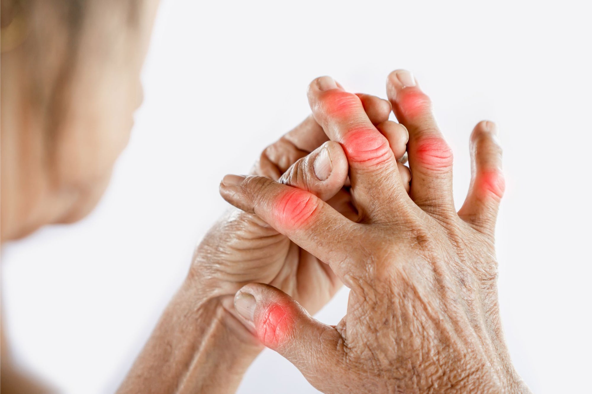 The Best Terpenes for Arthritis